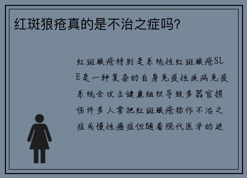 红斑狼疮真的是不治之症吗？